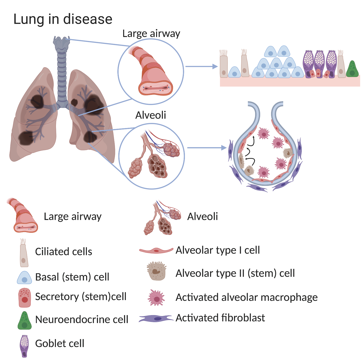 Interaction with lung cells transforms asbestos particles