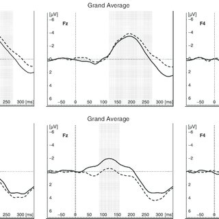 Whole-brain computation of cognitive versus acoustic errors in music: A mismatch negativity study