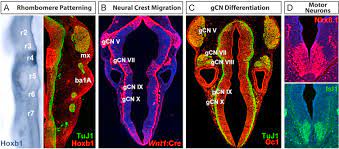 Neural disruptions underlying feeding, swallowing disorders in children identified