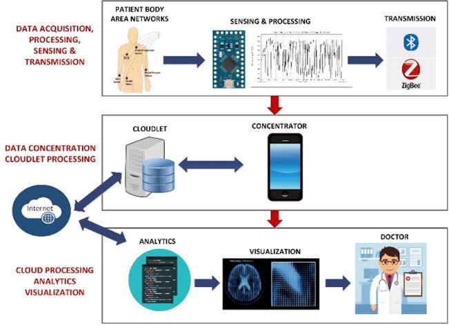 Revolutionizing Health Monitoring: Edge Computing and Wearable Sensor Technology