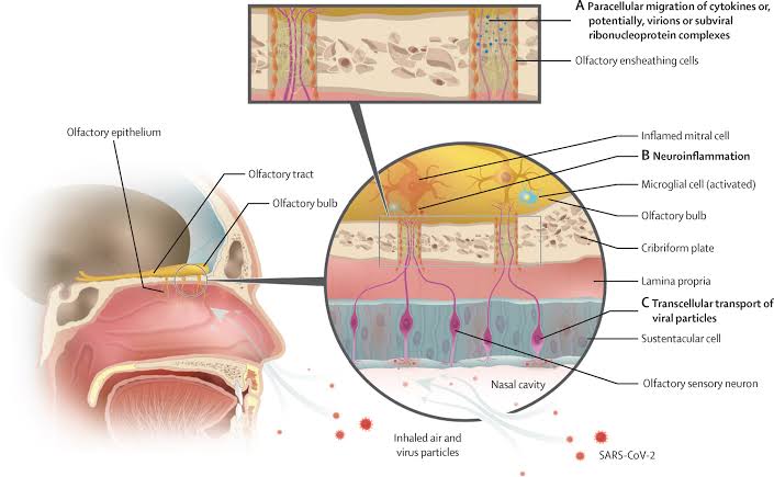 Olfactory Health and Inflammation: New Study Links Smell Loss to Over 100 Medical Conditions