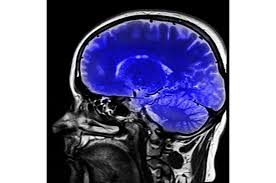 New Insights into the Amygdala: Identifying Cell Types for Targeted Treatments of Anxiety and Depression